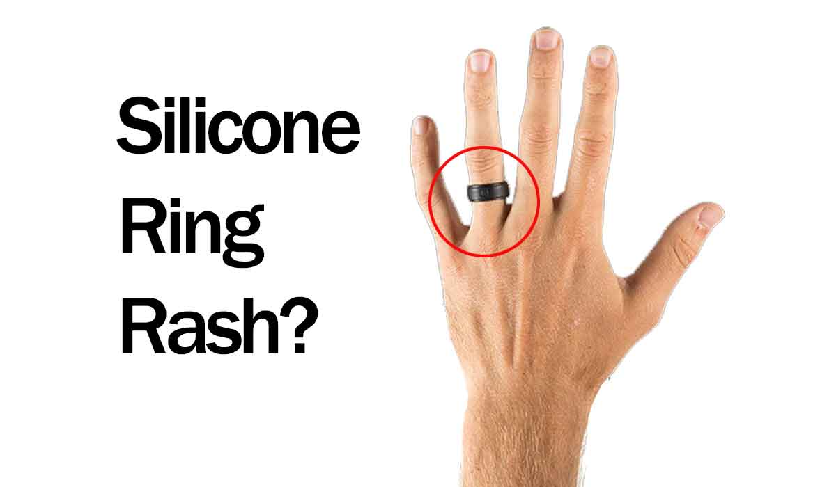 Silicone Ring Rash – Why it happens and how to prevent it